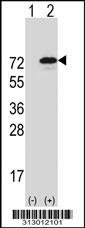 Western blot analysis of his-tag PDE4D (arrow) using his tag antibody. 293 cell lysates (2 ug/lane) either nontransfected (Lane 1) or transiently transfected with the PDE4D gene
