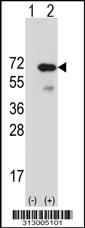 Western blot analysis of his-tag PAX7 (arrow) using his tag antibody. 293 cell lysates (2 ug/lane) either nontransfected (Lane 1) or transiently transfected with the PAX7 gene
