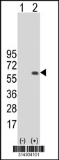 Western blot analysis of his-tag SLC7A6 (arrow) using his tag antibody. 293T cell lysates (2 ug/lane) either nontransfected (Lane 1) or transiently transfected with the SLC7A6 gene‘