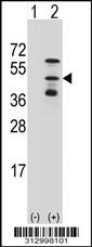 Western blot analysis of his-tag OXA1L (arrow) using his tag antibody. 293 cell lysates (2 ug/lane) either nontransfected (Lane 1) or transiently transfected with the OXA1L gene