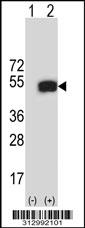 Western blot analysis of his-tag OGDH (arrow) using his tag antibody. 293 cell lysates (2 ug/lane) either nontransfected (Lane 1) or transiently transfected with the OGDH gene