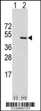Western blot analysis of his-tag ODC1 (arrow) using his tag antibody. 293 cell lysates (2 ug/lane) either nontransfected (Lane 1) or transiently transfected with the ODC1 gene