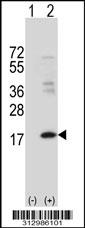 Western blot analysis of his-tag NPPB (arrow) using his tag antibody. 293 cell lysates (2 ug/lane) either nontransfected (Lane 1) or transiently transfected with the NPPB gene