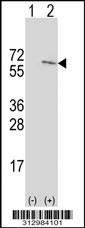 Western blot analysis of his-tag NONO (arrow) using his tag antibody. 293 cell lysates (2 ug/lane) either nontransfected (Lane 1) or transiently transfected with the NONO gene