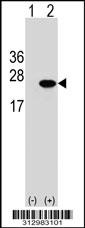 Western blot analysis of his-tag NHLH1 (arrow) using his tag antibody. 293 cell lysates (2 ug/lane) either nontransfected (Lane 1) or transiently transfected with the NHLH1 gene