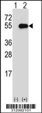 Western blot analysis of his-tag NFIX (arrow) using his tag antibody. 293 cell lysates (2 ug/lane) either nontransfected (Lane 1) or transiently transfected with the NFIX gene