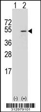 Western blot analysis of his-tag NFE2 (arrow) using his tag antibody. 293 cell lysates (2 ug/lane) either nontransfected (Lane 1) or transiently transfected with the NFE2 gene