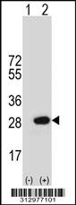 Western blot analysis of his-tag MYL3 (arrow) using his tag antibody. 293 cell lysates (2 ug/lane) either nontransfected (Lane 1) or transiently transfected with the MYL3 gene