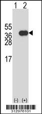 Western blot analysis of his-tag MYF6 (arrow) using his tag antibody. 293 cell lysates (2 ug/lane) either nontransfected (Lane 1) or transiently transfected with the MYF6 gene