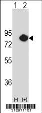 Western blot analysis of his-tag MSN (arrow) using his tag antibody. 293 cell lysates (2 ug/lane) either nontransfected (Lane 1) or transiently transfected with the MSN gene