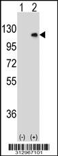 Western blot analysis of his-tag ECE1 (arrow) using his tag antibody. 293 cell lysates (2 ug/lane) either nontransfected (Lane 1) or transiently transfected with the ECE1 gene