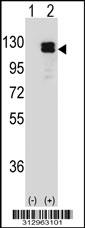 Western blot analysis of his-tag AXL (arrow) using his tag antibody. 293 cell lysates (2 ug/lane) either nontransfected (Lane 1) or transiently transfected with the AXL gene
