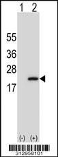 Western blot analysis of his-tag PDE6D (arrow) using his tag antibody. 293 cell lysates (2 ug/lane) either nontransfected (Lane 1) or transiently transfected with the PDE6D gene