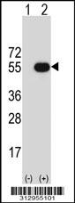 Western blot analysis of his-tag NFIC (arrow) using his tag antibody. 293 cell lysates (2 ug/lane) either nontransfected (Lane 1) or transiently transfected with the NFIC gene