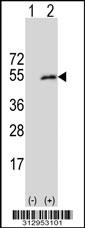 Western blot analysis of his-tag DRG1 (arrow) using his tag antibody. 293 cell lysates (2 ug/lane) either nontransfected (Lane 1) or transiently transfected with the DRG1 gene