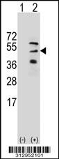 Western blot analysis of his-tag DENND1B (arrow) using his tag antibody. 293 cell lysates (2 ug/lane) either nontransfected (Lane 1) or transiently transfected with the DENND1B gene