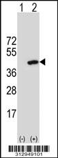 Western blot analysis of his-tag UCHL5 (arrow) using his tag antibody. 293 cell lysates (2 ug/lane) either nontransfected (Lane 1) or transiently transfected with the UCHL5 gene