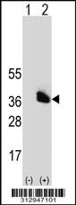 Western blot analysis of his-tag STC2 (arrow) using his tag antibody. 293 cell lysates (2 ug/lane) either nontransfected (Lane 1) or transiently transfected with the STC2 gene