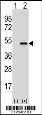Western blot analysis of his-tag ST3GAL3 (arrow) using his tag antibody. 293 cell lysates (2 ug/lane) either nontransfected (Lane 1) or transiently transfected with the ST3GAL3 gene