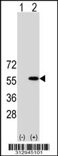 Western blot analysis of his-tag SOX10 (arrow) using his tag antibody. 293 cell lysates (2 ug/lane) either nontransfected (Lane 1) or transiently transfected with the SOX10 gene