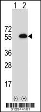 Western blot analysis of his-tag SMAD3 (arrow) using his tag antibody. 293 cell lysates (2 ug/lane) either nontransfected (Lane 1) or transiently transfected with the SMAD3 gene