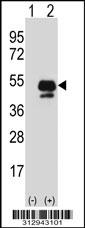 Western blot analysis of his-tag SIRT6 (arrow) using his tag antibody. 293 cell lysates (2 ug/lane) either nontransfected (Lane 1) or transiently transfected with the SIRT6 gene