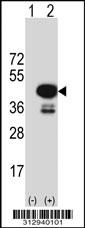 Western blot analysis of his-tag NEU2 (arrow) using his tag antibody. 293 cell lysates (2 ug/lane) either nontransfected (Lane 1) or transiently transfected with the NEU2 gene