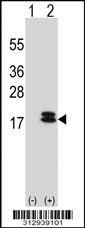 Western blot analysis of his-tag NDUFS6 (arrow) using his tag antibody. 293 cell lysates (2 ug/lane) either nontransfected (Lane 1) or transiently transfected with the NDUFS6 gene