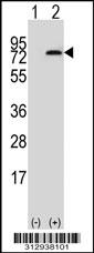 Western blot analysis of his-tag NDUFS1 (arrow) using his tag antibody. 293 cell lysates (2 ug/lane) either nontransfected (Lane 1) or transiently transfected with the NDUFS1 gene
