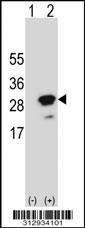 Western blot analysis of his-tag MOCS2 (arrow) using his tag antibody. 293 cell lysates (2 ug/lane) either nontransfected (Lane 1) or transiently transfected with the MOCS2 gene