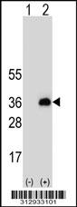 Western blot analysis of his-tag MOCS1 (arrow) using his tag antibody. 293 cell lysates (2 ug/lane) either nontransfected (Lane 1) or transiently transfected with the MOCS1 gene