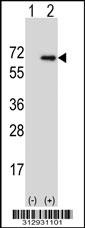 Western blot analysis of his-tag MMP3 (arrow) using his tag antibody. 293 cell lysates (2 ug/lane) either nontransfected (Lane 1) or transiently transfected with the MMP3 gene