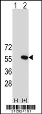 Western blot analysis of his-tag MGAT2 (arrow) using his tag antibody. 293 cell lysates (2 ug/lane) either nontransfected (Lane 1) or transiently transfected with the MGAT2 gene
