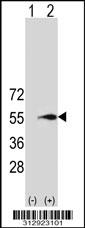 Western blot analysis of his-tag MGAT1 (arrow) using his tag antibody. 293 cell lysates (2 ug/lane) either nontransfected (Lane 1) or transiently transfected with the MGAT1 gene