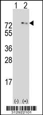 Western blot analysis of his-tag MDM4 (arrow) using his tag antibody. 293 cell lysates (2 ug/lane) either nontransfected (Lane 1) or transiently transfected with the MDM4 gene