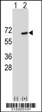 Western blot analysis of his-tag MARCO (arrow) using his tag antibody. 293 cell lysates (2 ug/lane) either nontransfected (Lane 1) or transiently transfected with the MARCO gene
