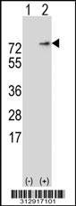 Western blot analysis of his-tag LIPC (arrow) using his tag antibody. 293 cell lysates (2 ug/lane) either nontransfected (Lane 1) or transiently transfected with the LIPC gene