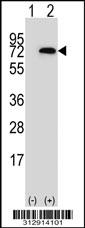 Western blot analysis of his-tag LCP1 (arrow) using his tag antibody. 293 cell lysates (2 ug/lane) either nontransfected (Lane 1) or transiently transfected with the LCP1 gene