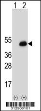 Western blot analysis of his-tag CD200 (arrow) using his tag antibody. 293 cell lysates (2 ug/lane) either nontransfected (Lane 1) or transiently transfected with the CD200 gene