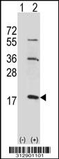 Western blot analysis of his-tag SH2D1A (arrow) using his tag antibody. 293 cell lysates (2 ug/lane) either nontransfected (Lane 1) or transiently transfected with the SH2D1A gene