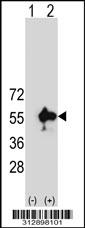 Western blot analysis of his-tag NDUFV1 (arrow) using his tag antibody. 293 cell lysates (2 ug/lane) either nontransfected (Lane 1) or transiently transfected with the NDUFV1 gene