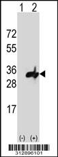 Western blot analysis of his-tag NDUFS3 (arrow) using his tag antibody. 293 cell lysates (2 ug/lane) either nontransfected (Lane 1) or transiently transfected with the NDUFS3 gene