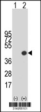 Western blot analysis of his-tag CDCA7 (arrow) using his tag antibody. 293T cell lysates (2 ug/lane) either nontransfected (Lane 1) or transiently transfected with the CDCA7 gene‘
