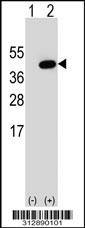 Western blot analysis of his-tag MXD1 (arrow) using his tag antibody. 293 cell lysates (2 ug/lane) either nontransfected (Lane 1) or transiently transfected with the MXD1 gene