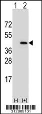 Western blot analysis of his-tag MNAT1 (arrow) using his tag antibody. 293 cell lysates (2 ug/lane) either nontransfected (Lane 1) or transiently transfected with the MNAT1 gene