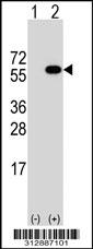 Western blot analysis of his-tag MMP1 (arrow) using his tag antibody. 293 cell lysates (2 ug/lane) either nontransfected (Lane 1) or transiently transfected with the MMP1 gene