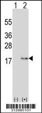 Western blot analysis of his-tag MGP (arrow) using his tag antibody. 293 cell lysates (2 ug/lane) either nontransfected (Lane 1) or transiently transfected with the MGP gene