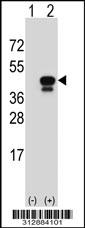 Western blot analysis of his-tag MFI2 (arrow) using his tag antibody. 293 cell lysates (2 ug/lane) either nontransfected (Lane 1) or transiently transfected with the MFI2 gene