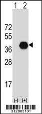 Western blot analysis of his-tag MFGE8 (arrow) using his tag antibody. 293 cell lysates (2 ug/lane) either nontransfected (Lane 1) or transiently transfected with the MFGE8 gene
