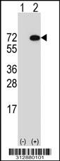 Western blot analysis of his-tag MEIS2 (arrow) using his tag antibody. 293 cell lysates (2 ug/lane) either nontransfected (Lane 1) or transiently transfected with the MEIS2 gene